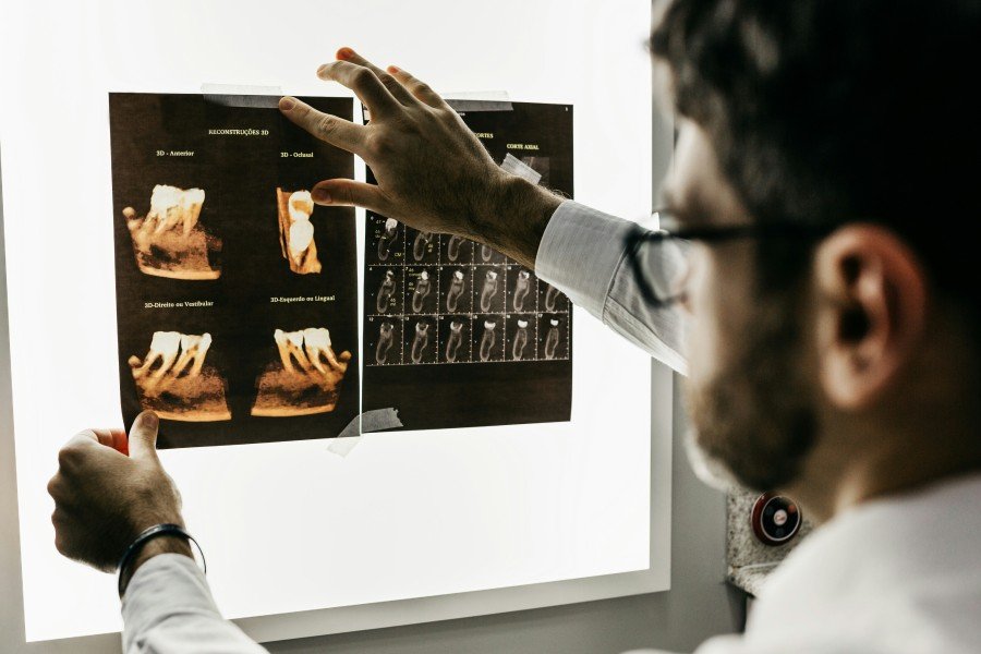 Dentist examining dental X-ray images displayed on a lightbox.