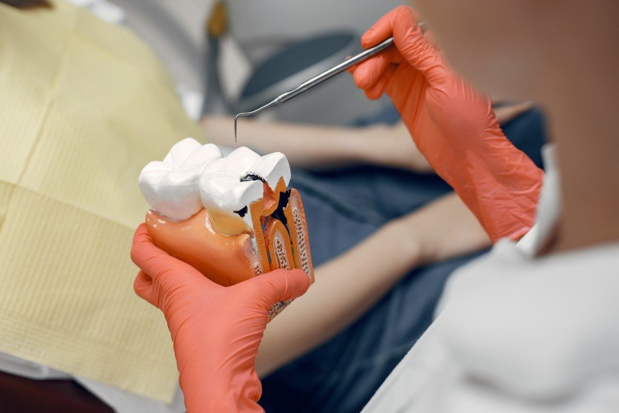 Dentist explaining a root canal procedure using a cross-sectional tooth model during a dental consultation in Sector 104 Gurugram.